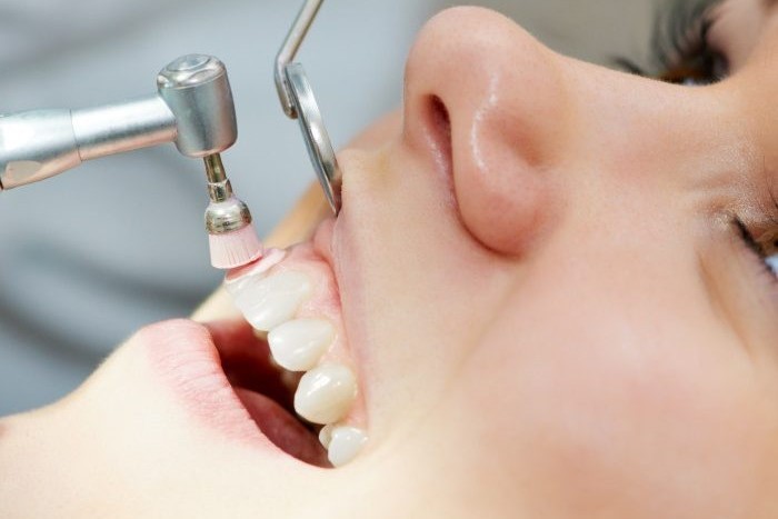 Аппаратная чистка зубов Эндостом